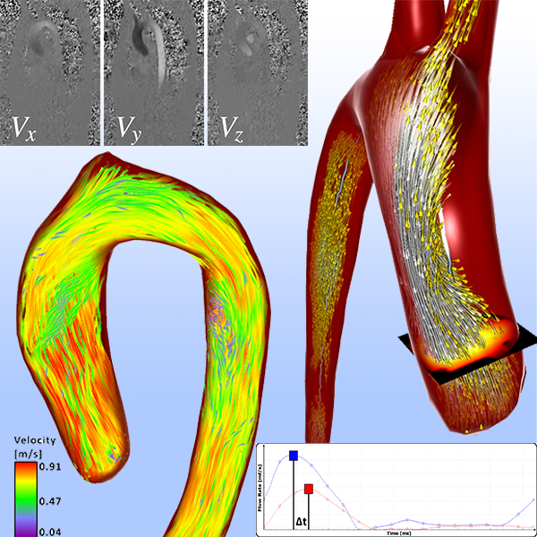 A Survey of Cardiac 4D PC-MRI Data Processing