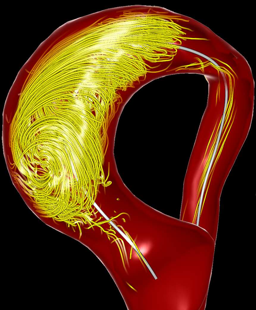 Adaptive Animations of Vortex Flow Extracted from Cardiac 4D PC-MRI Data