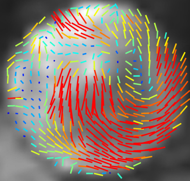A Survey of Cardiac 4D PC-MRI Data Processing