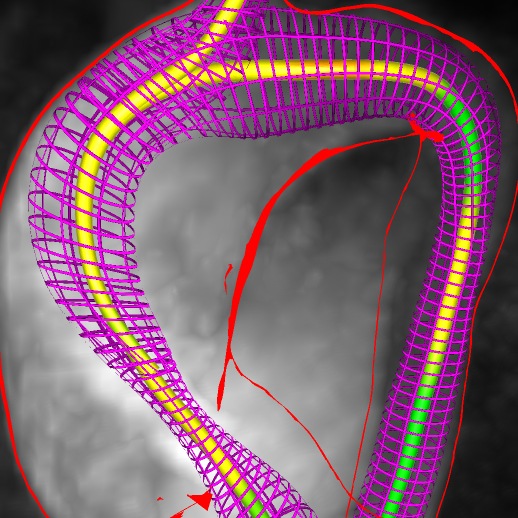 Visual and Quantitative Analysis of Great Arteries' Blood Flow Jets in Cardiac 4D PC-MRI Data