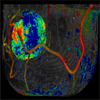 Exploration of time-varying data for Medical Diagnosis