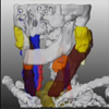 Interactive Visualization for Neck Dissection Planning