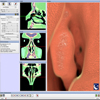 Sinus Endoscopy - Application of Advanced GPU Volume Rendering for Virtual Endoscopy