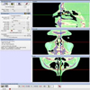 Advanced GPU Volume Rendering for Virtual Endoscopy