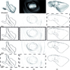 Qualitative Evaluation of Feature Lines on Anatomical Surfaces