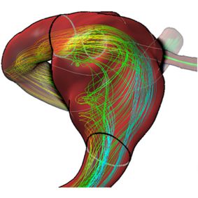 A Survey on Multimodal Medical Data Visualization