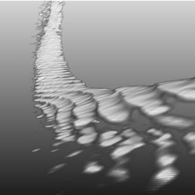 Bone Fracture and Lesion Assessment using Shape-Adaptive Unfolding