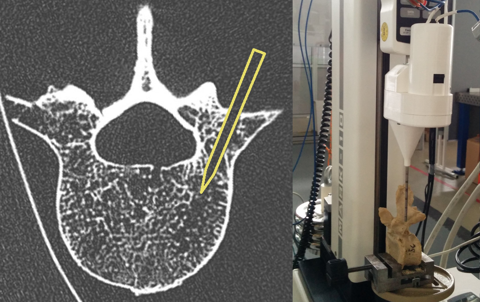 Two-Step Trajectory Visualization for Robot-Assisted Spine Radiofrequency Ablations