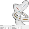 Management of Cerebral Aneurysm Descriptors based on an Automatic Ostium Extraction