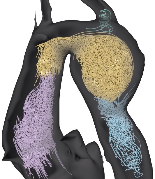 Clustering of Aortic Vortex Flow in Cardiac 4D PC-MRI Data