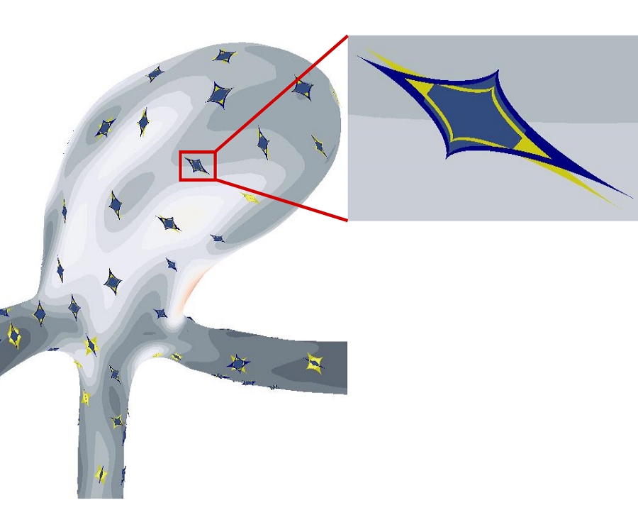 Glyph-Based Comparative Stress Tensor Visualization in Cerebral Aneurysms