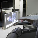 A Gesture-Controlled Projection Display for CT-Guided Interventions
