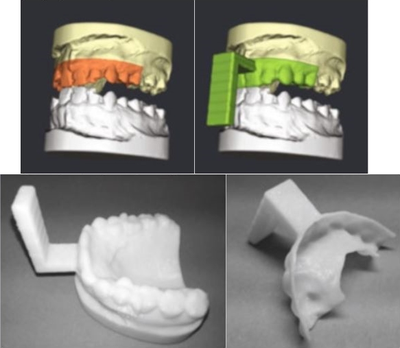 Dental Splint Fabrication for Prospective Motion Correction in Ultrahigh-Field MR Imaging