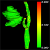 Generation of Smooth and Accurate Surface Models for Surgical Planning