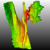 Generation of Smooth and Accurate Surface Models for Surgical Planning and Simulation