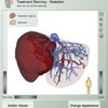 The LiverSurgeryTrainer: training of computer-based planning in liver resection surgery