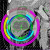 Constrained Labeling of 2D Slice Data for Reading Images in Radiology