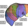 Automatische Annotation medizinischer 2D- und 3D-Visualisierungen
