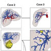 Reusable Visualizations and Animations for Surgery Planning