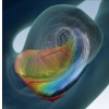 Interactive Medical Volume Visualizations for Surgical Online Applications