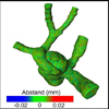 Generierung qualitativ hochwertiger Modelle für die Simulation von Blutfluss in zerebralen Aneurysmen