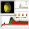 Visual Analysis of Cerebral Perfusion Data -- Four Interactive Approaches and a Comparison