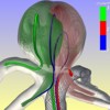 Evaluation of Streamline Clustering Techniques for Blood Flow Data