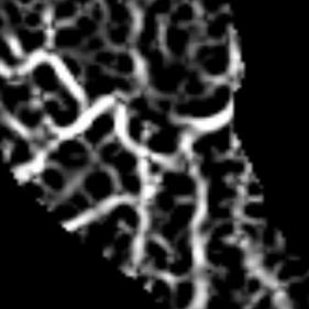 Objective quantification of the vocal fold vascular pattern: comparison of narrow band imaging and white light endoscopy