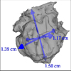 Interaktive und automatische Vermessung medizinischer 3d Visualisierungen