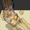 Techniken zur Hervorhebung von Objekten in medizinischen 3d-Visualisierungen