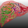 Visualisierungs- und Interaktionstechniken für die Planung lokaler Therapien