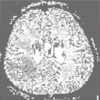 Mehrdimensionale Visualisierung dynamischer Bilddaten am Beispiel der Durchblutungsquantifizierung