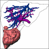 Model-Based Visualization for Intervention Planning