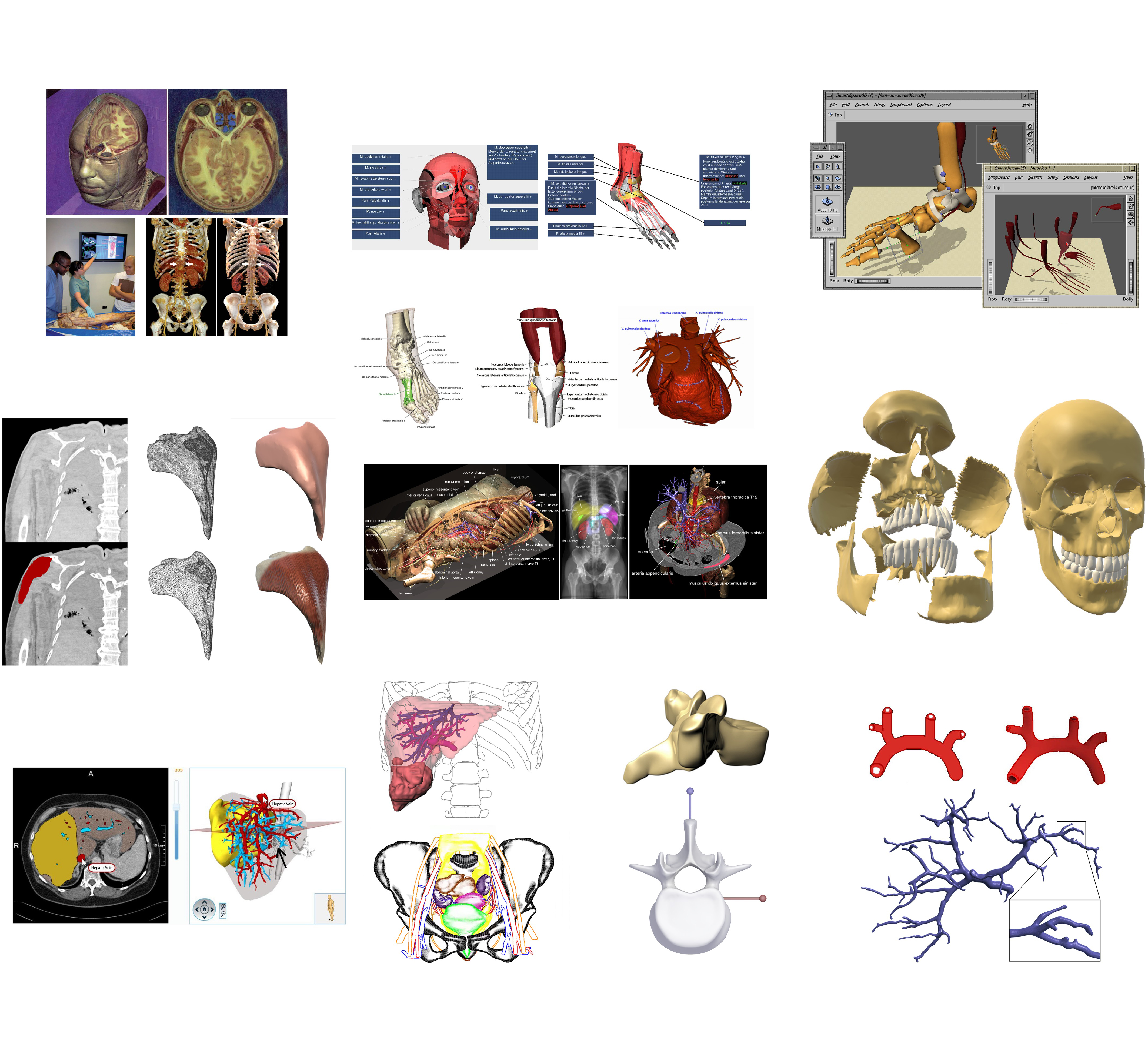 A Survey of Virtual Human Anatomy Education Systems