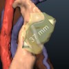 Fast and flexible distance measures for treatment planning