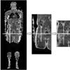 Multi-Level Approach for the Discriminative Generalized Hough Tranform