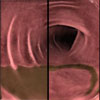 Real-time surface analysis and tagged material cleansing for virtual colonoscopy