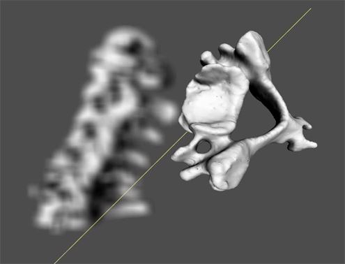 Das 3D User Interface zSpace - Verwendung zur Exploration und Inspektion von Wirbeln der Halswirbelsäule