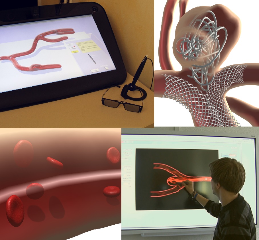 Sketching and Annotating Vascular Structures to Support Medical Teaching, Treatment Planning and Patient Education