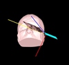 Navigation-Supported Diagnosis of the Substantia Nigra by Matching Midbrain Sonography and MRI