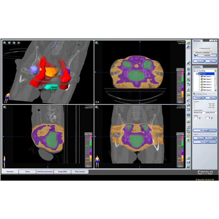 State-of-the-Art Report: Visual Computing in Radiation Therapy Planning