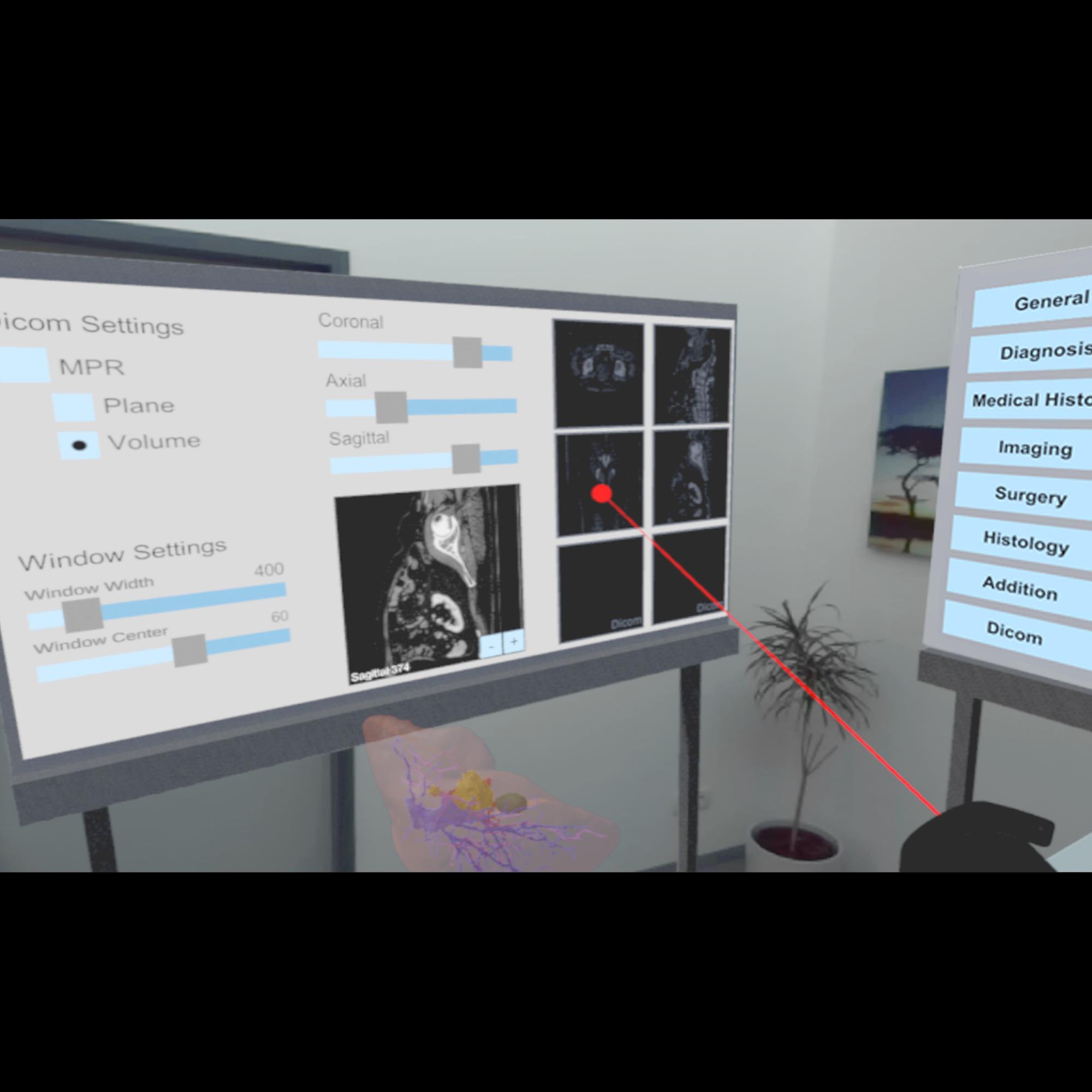A VR/AR Environment for Multi-User Liver Anatomy Education