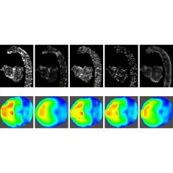 Comparison of Divergence-Free Filters for Cardiac 4D PC-MRI Data