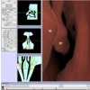 Virtual endoscopy of the nose and paranasal sinuses in real-time. Surgical planning system - Sinus endoscopy (SPS-SE)