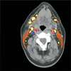 Enhancing Slice-based Visuaizations of Medical Volume Data