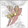 Curvature- and Model-Based Surface Hatching of Patient-Specific Muscle Surfaces