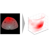 Automated incisional hernia characterization by non-rigid registration of CT images – a pilot study